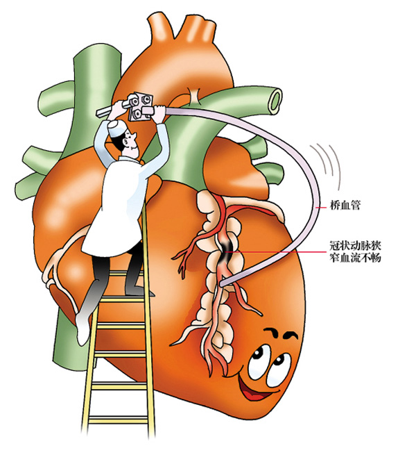 冠心病病例护理_冠心病护理整体护理病历范文_护理病例讨论冠心病