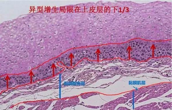 康复治疗论坛_中医胃病康复网_胃病康复论坛