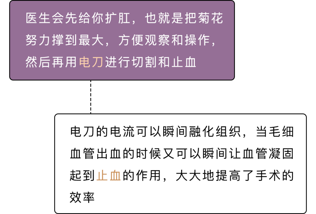 痔疮肛瘘手术后几天能正常大便_痔疮手术肛瘘手术多久能好_痔疮 肛瘘手术时间