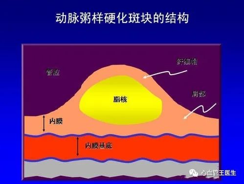 冠心病得预防治疗方法_预防冠心病的有效措施_预防冠心病用什么药好