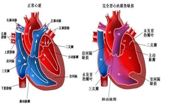 什么是呼吸衰竭分型_呼吸衰竭定义和分类_呼吸衰竭的定义及分型