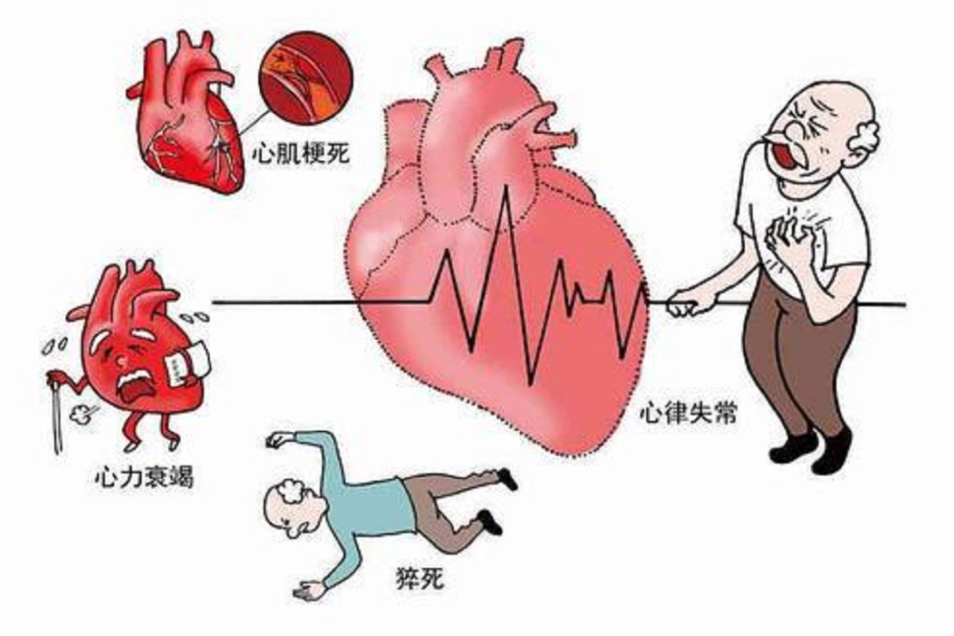 冠心病护理个案_护理个案冠心病比赛_护理个案冠心病pio