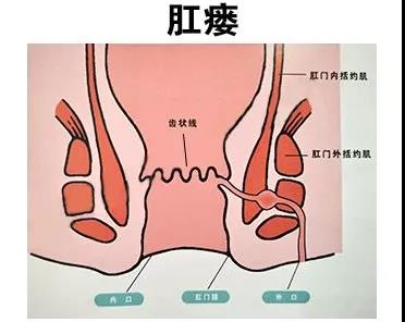 大便拉出鲜血_鲜血大便拉出黑色_大便血拉出来