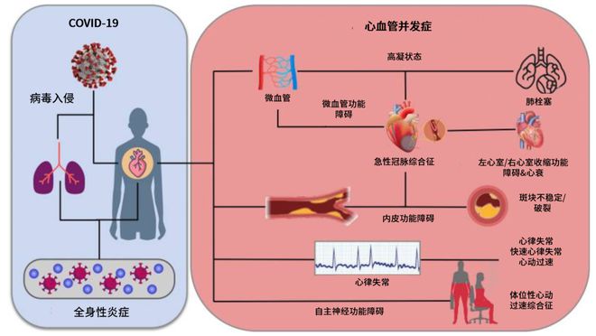 高血压冠心病能除根吗_血压高冠心病_得了冠心病高血压能活几年