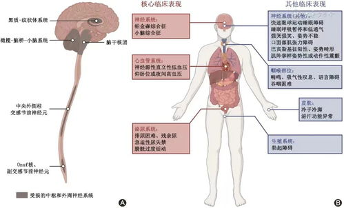 多系统萎缩病程,病程演变与综合治疗策略