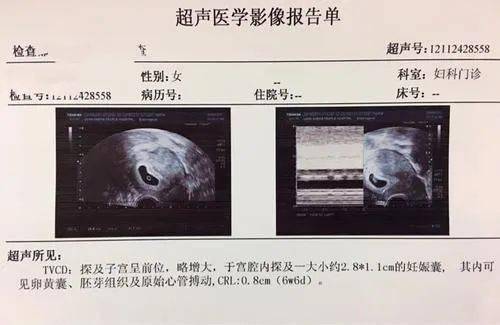 防御系统b超,B超技术在防御系统检测与评估中的应用概述